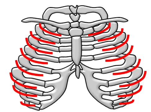 自然気胸に似た肋間神経痛の画像
